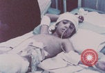 Image of wounded Iranians Iran, 1980, second 16 stock footage video 65675078926