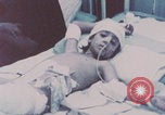 Image of wounded Iranians Iran, 1980, second 17 stock footage video 65675078926