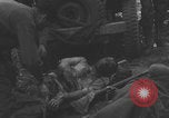 Image of USA soldier burn victim treated WW2 Saint Lo France, 1944, second 6 stock footage video 65675079320