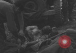 Image of USA soldier burn victim treated WW2 Saint Lo France, 1944, second 7 stock footage video 65675079320