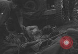 Image of USA soldier burn victim treated WW2 Saint Lo France, 1944, second 8 stock footage video 65675079320