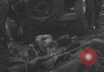 Image of USA soldier burn victim treated WW2 Saint Lo France, 1944, second 9 stock footage video 65675079320
