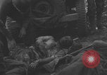 Image of USA soldier burn victim treated WW2 Saint Lo France, 1944, second 10 stock footage video 65675079320
