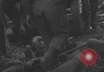 Image of USA soldier burn victim treated WW2 Saint Lo France, 1944, second 12 stock footage video 65675079320