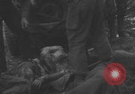 Image of USA soldier burn victim treated WW2 Saint Lo France, 1944, second 13 stock footage video 65675079320