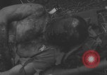 Image of USA soldier burn victim treated WW2 Saint Lo France, 1944, second 14 stock footage video 65675079320