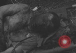 Image of USA soldier burn victim treated WW2 Saint Lo France, 1944, second 15 stock footage video 65675079320