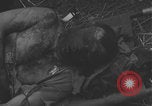 Image of USA soldier burn victim treated WW2 Saint Lo France, 1944, second 16 stock footage video 65675079320