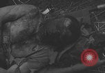 Image of USA soldier burn victim treated WW2 Saint Lo France, 1944, second 17 stock footage video 65675079320