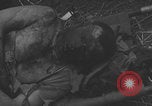 Image of USA soldier burn victim treated WW2 Saint Lo France, 1944, second 18 stock footage video 65675079320