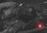 Image of USA soldier burn victim treated WW2 Saint Lo France, 1944, second 19 stock footage video 65675079320