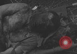 Image of USA soldier burn victim treated WW2 Saint Lo France, 1944, second 20 stock footage video 65675079320