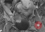 Image of USA soldier burn victim treated WW2 Saint Lo France, 1944, second 21 stock footage video 65675079320