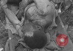 Image of USA soldier burn victim treated WW2 Saint Lo France, 1944, second 22 stock footage video 65675079320
