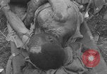 Image of USA soldier burn victim treated WW2 Saint Lo France, 1944, second 23 stock footage video 65675079320