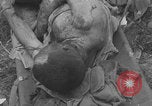 Image of USA soldier burn victim treated WW2 Saint Lo France, 1944, second 24 stock footage video 65675079320
