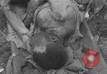 Image of USA soldier burn victim treated WW2 Saint Lo France, 1944, second 25 stock footage video 65675079320