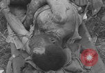 Image of USA soldier burn victim treated WW2 Saint Lo France, 1944, second 26 stock footage video 65675079320
