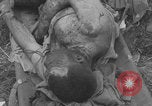 Image of USA soldier burn victim treated WW2 Saint Lo France, 1944, second 27 stock footage video 65675079320