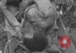 Image of USA soldier burn victim treated WW2 Saint Lo France, 1944, second 28 stock footage video 65675079320