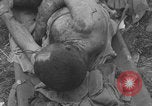 Image of USA soldier burn victim treated WW2 Saint Lo France, 1944, second 29 stock footage video 65675079320