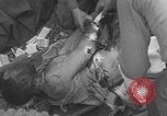 Image of USA soldier burn victim treated WW2 Saint Lo France, 1944, second 30 stock footage video 65675079320