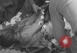 Image of USA soldier burn victim treated WW2 Saint Lo France, 1944, second 31 stock footage video 65675079320