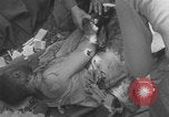 Image of USA soldier burn victim treated WW2 Saint Lo France, 1944, second 32 stock footage video 65675079320
