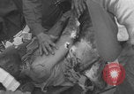 Image of USA soldier burn victim treated WW2 Saint Lo France, 1944, second 34 stock footage video 65675079320