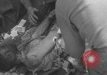 Image of USA soldier burn victim treated WW2 Saint Lo France, 1944, second 35 stock footage video 65675079320