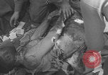Image of USA soldier burn victim treated WW2 Saint Lo France, 1944, second 37 stock footage video 65675079320
