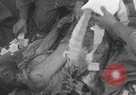 Image of USA soldier burn victim treated WW2 Saint Lo France, 1944, second 38 stock footage video 65675079320