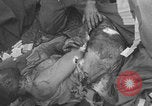 Image of USA soldier burn victim treated WW2 Saint Lo France, 1944, second 39 stock footage video 65675079320