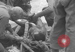 Image of USA soldier burn victim treated WW2 Saint Lo France, 1944, second 40 stock footage video 65675079320