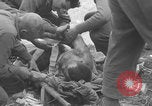 Image of USA soldier burn victim treated WW2 Saint Lo France, 1944, second 41 stock footage video 65675079320