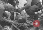 Image of USA soldier burn victim treated WW2 Saint Lo France, 1944, second 42 stock footage video 65675079320