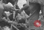Image of USA soldier burn victim treated WW2 Saint Lo France, 1944, second 43 stock footage video 65675079320