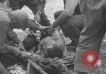 Image of USA soldier burn victim treated WW2 Saint Lo France, 1944, second 44 stock footage video 65675079320