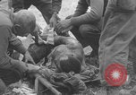Image of USA soldier burn victim treated WW2 Saint Lo France, 1944, second 46 stock footage video 65675079320