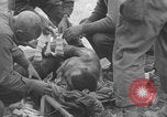 Image of USA soldier burn victim treated WW2 Saint Lo France, 1944, second 47 stock footage video 65675079320