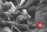 Image of USA soldier burn victim treated WW2 Saint Lo France, 1944, second 48 stock footage video 65675079320