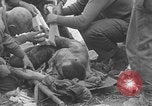 Image of USA soldier burn victim treated WW2 Saint Lo France, 1944, second 49 stock footage video 65675079320