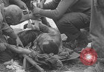 Image of USA soldier burn victim treated WW2 Saint Lo France, 1944, second 50 stock footage video 65675079320