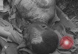 Image of USA soldier burn victim treated WW2 Saint Lo France, 1944, second 51 stock footage video 65675079320