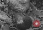 Image of USA soldier burn victim treated WW2 Saint Lo France, 1944, second 52 stock footage video 65675079320