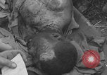 Image of USA soldier burn victim treated WW2 Saint Lo France, 1944, second 54 stock footage video 65675079320