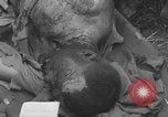 Image of USA soldier burn victim treated WW2 Saint Lo France, 1944, second 55 stock footage video 65675079320