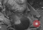 Image of USA soldier burn victim treated WW2 Saint Lo France, 1944, second 56 stock footage video 65675079320