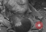 Image of USA soldier burn victim treated WW2 Saint Lo France, 1944, second 58 stock footage video 65675079320