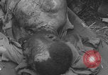 Image of USA soldier burn victim treated WW2 Saint Lo France, 1944, second 59 stock footage video 65675079320